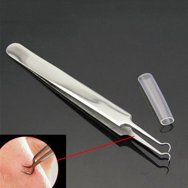 Blackhead Remove Tweezer