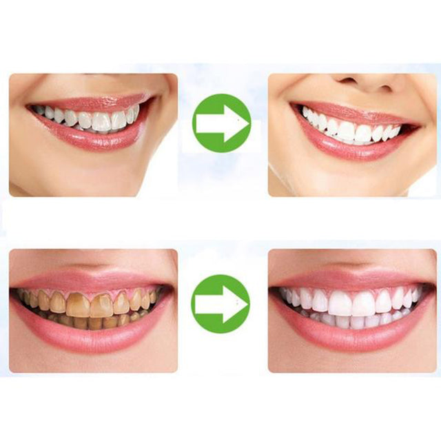 Activated Organic Charcoal Natural Teeth Whitening DONE